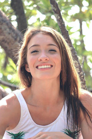 model-2890203_640 300X451 composite fillings