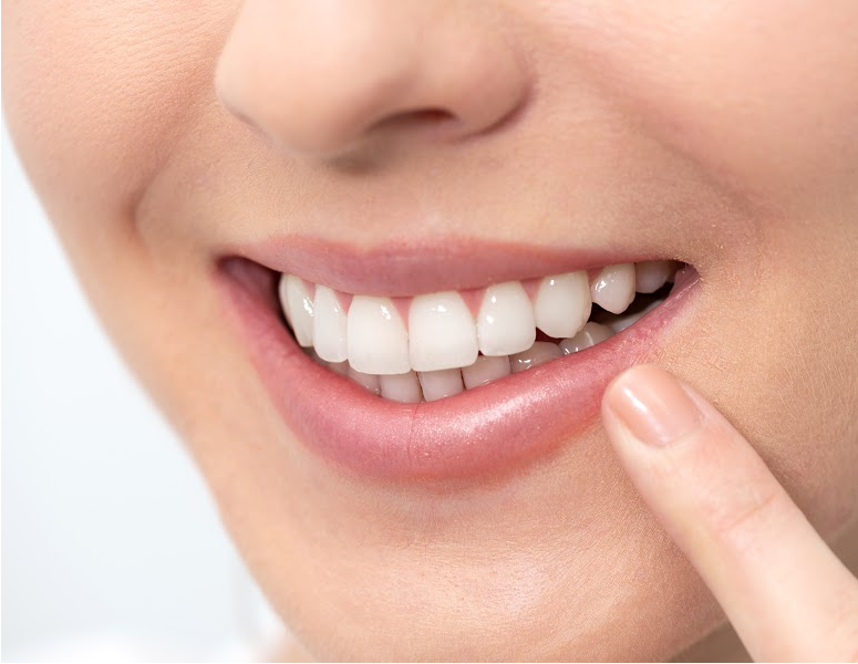 full mouth reconstruction_ocala dental care_pmon20210519 full mouth reconstruction