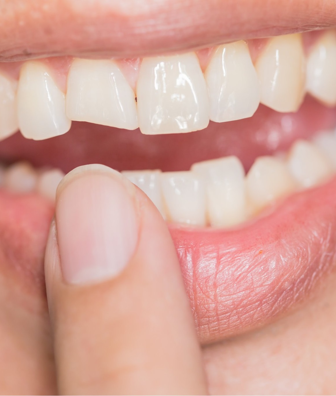dental emergency