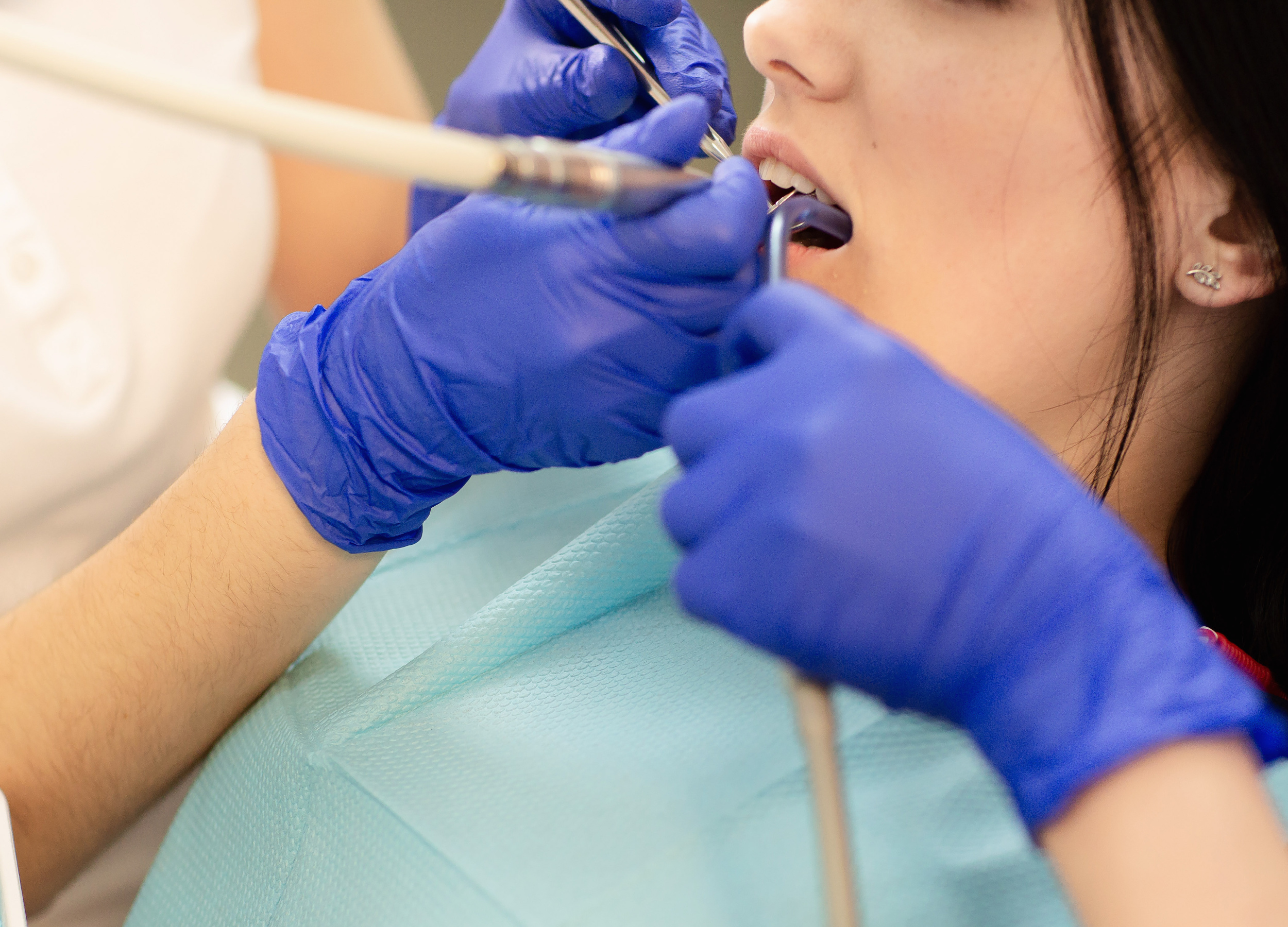 dental implant surgery
